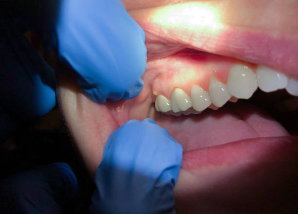 Best Emergency Treatment for Jaw Pain or Injury in Clinton, IL