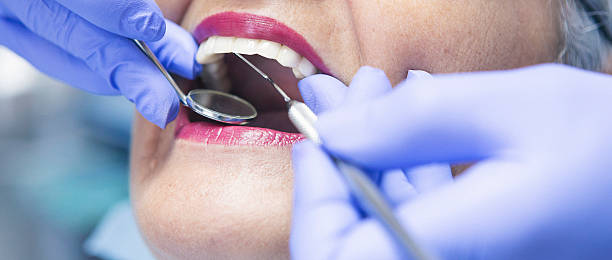 Professional Emergency Dental Service in IL